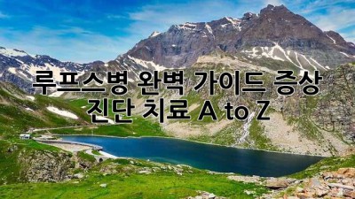 루프스병 완벽 가이드: 증상, 진단, 치료 A to Z 🦋